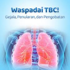 Gambar artikel Waspadai TBC!